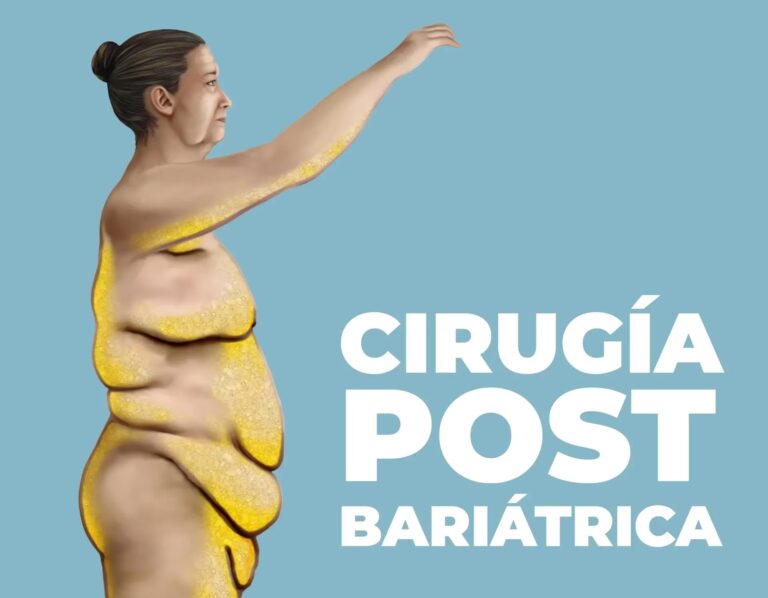 Tu Dieta Tras la Manga Gástrica: Las 4 Fases