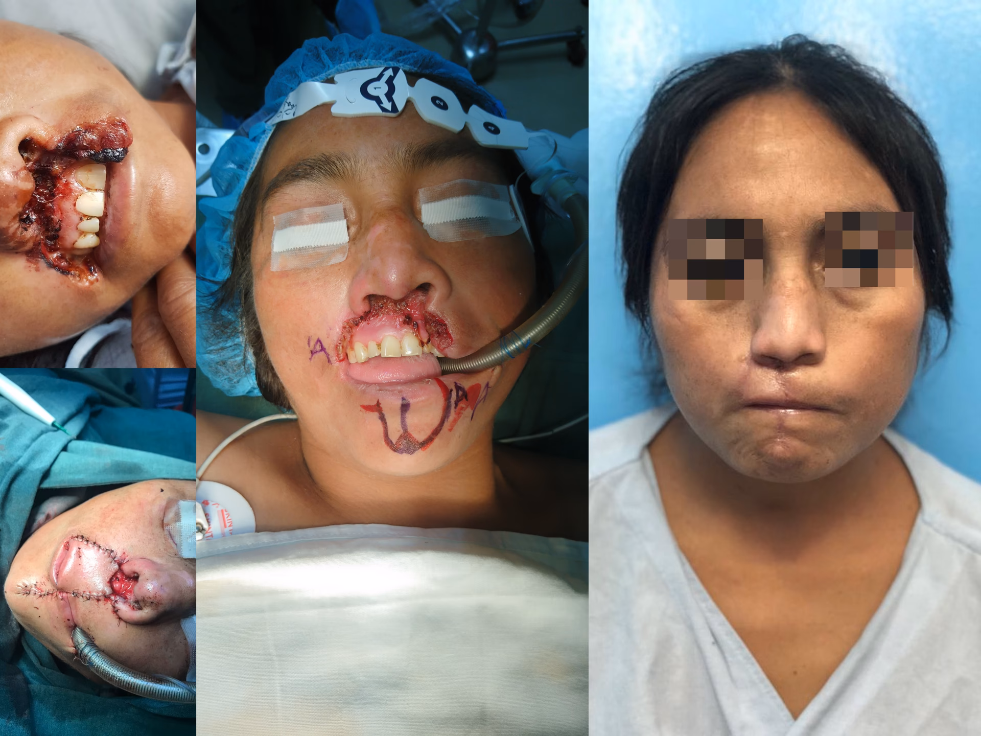 ¿Cuáles son las cirugías reconstructivas?