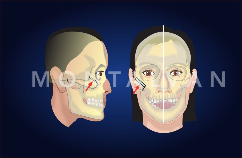 El Viaje de tu Piel: Cicatrización de Raspaduras