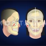 El Viaje de tu Piel: Cicatrización de Raspaduras