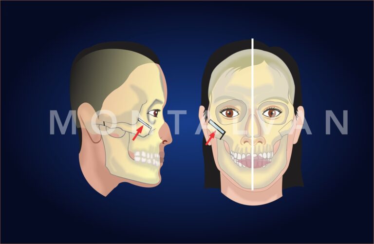 El Viaje de tu Piel: Cicatrización de Raspaduras