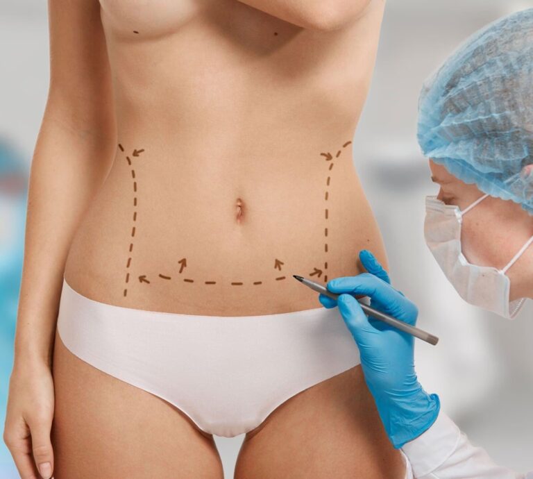 Espumas y Tablas: Claves Bajo tu Faja Postquirúrgica