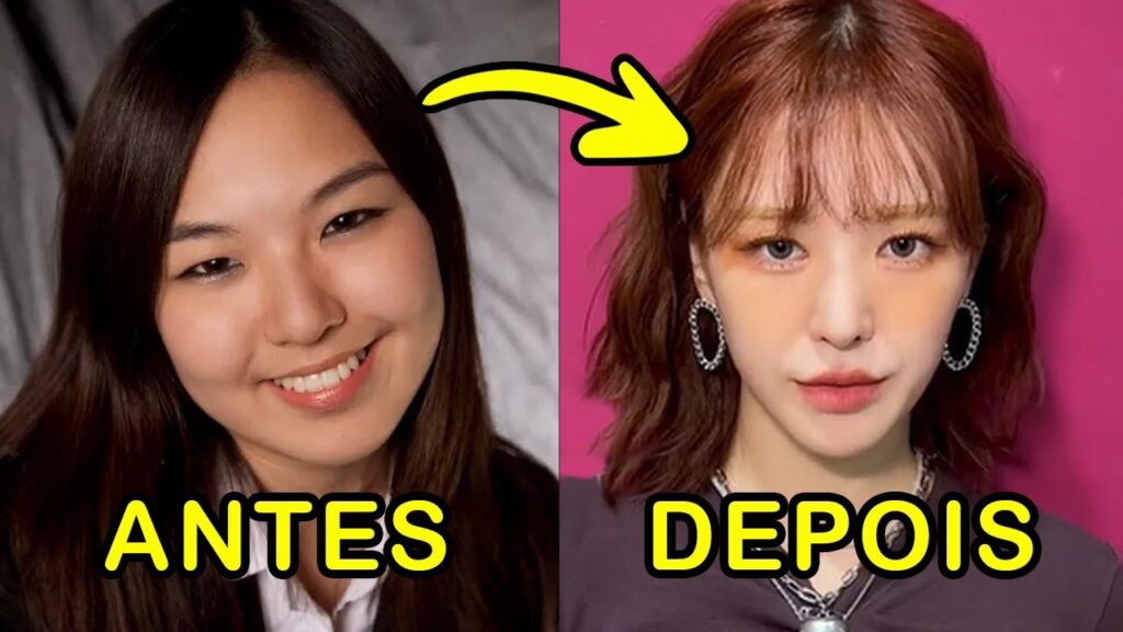Wendy de Red Velvet: La Verdad Tras su Cirugía