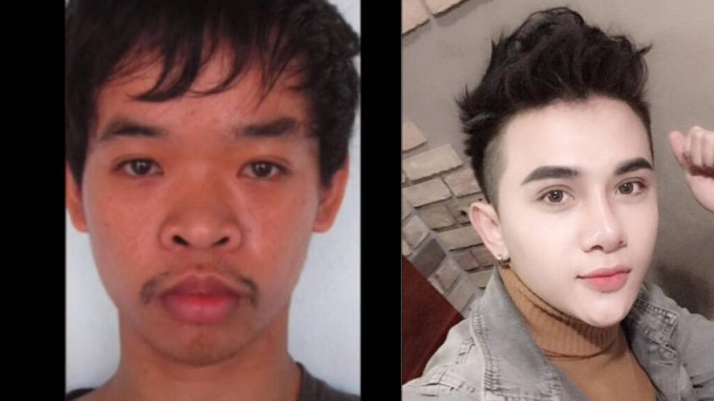 Uglies: La Cirugía Ficticia para ser “Perfecto”