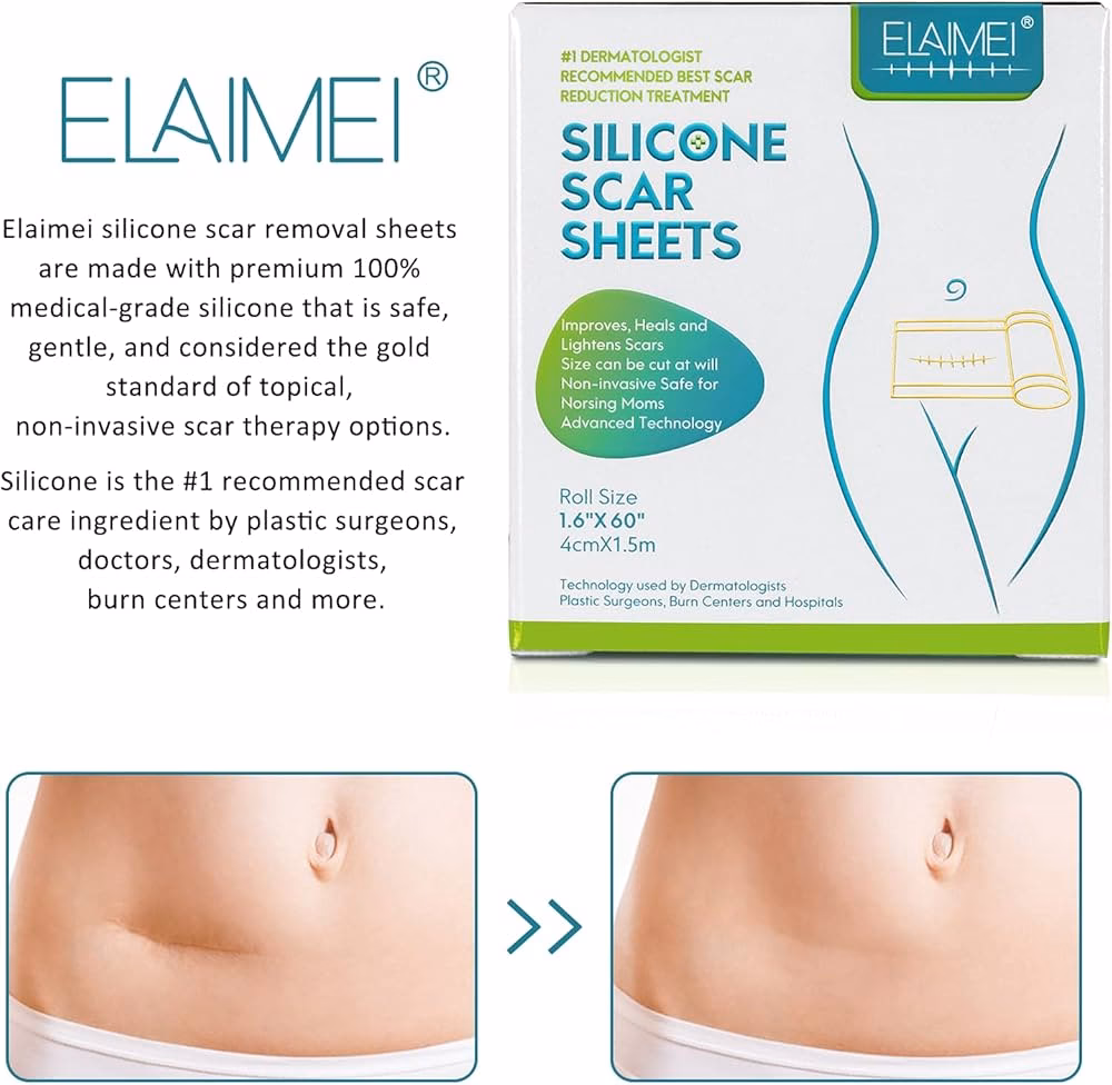 ¿Realmente funciona la silicona para las cicatrices?