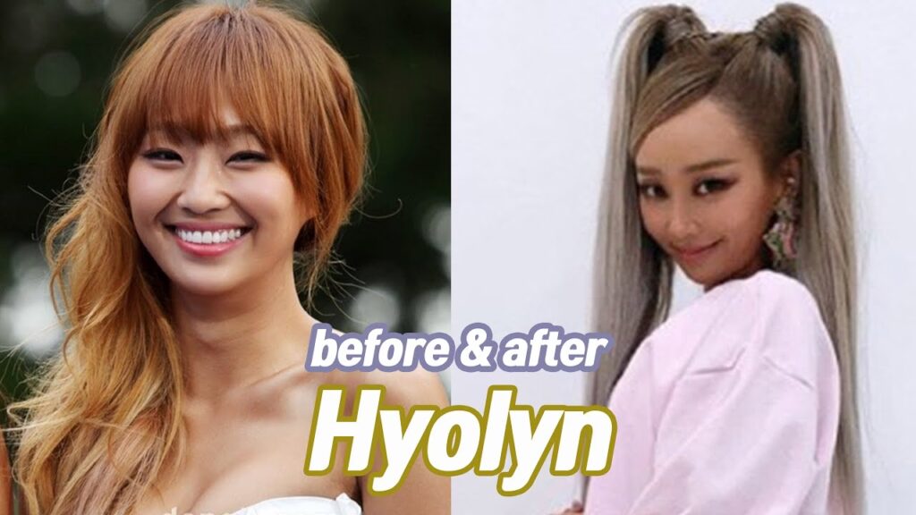 La Verdad sobre las Cirugías de Hyolyn