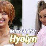 La Verdad sobre las Cirugías de Hyolyn