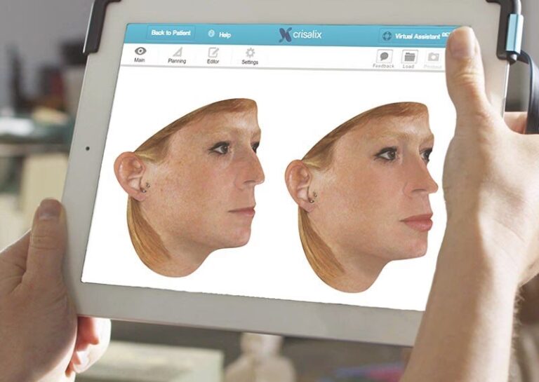 IA en Cirugía Plástica: ¿El Futuro es Ahora?