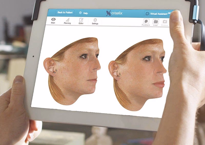 IA en Cirugía Plástica: ¿El Futuro es Ahora?