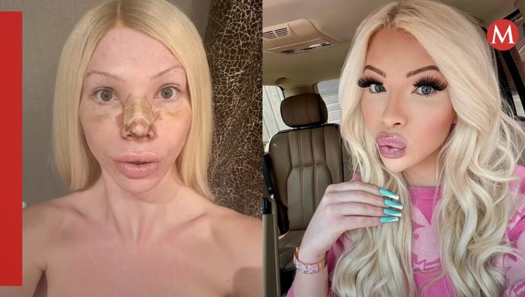 Cirugía Plástica en el Hospital Churruca y IOSFA