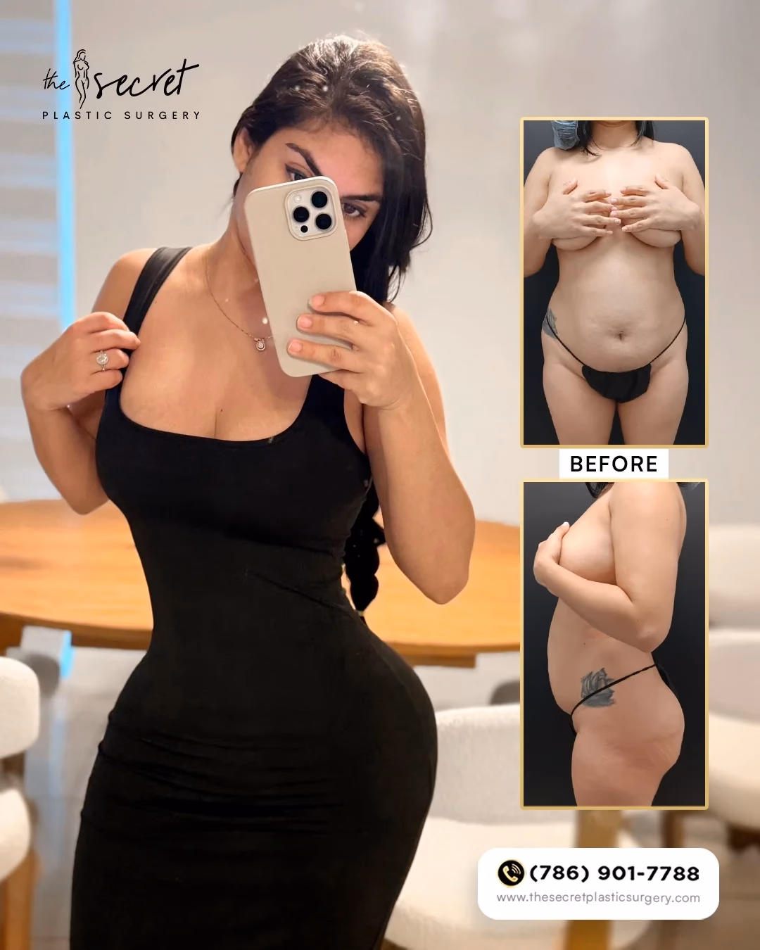 ¿Cuál es la obra social de PFA?