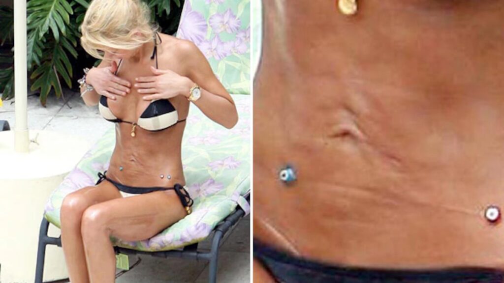 Tara Reid: El Precio de una Cirugía Fallida