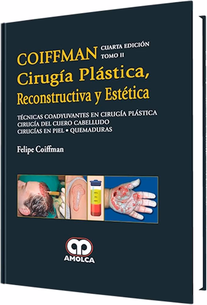 ¿Qué son las técnicas de operación?