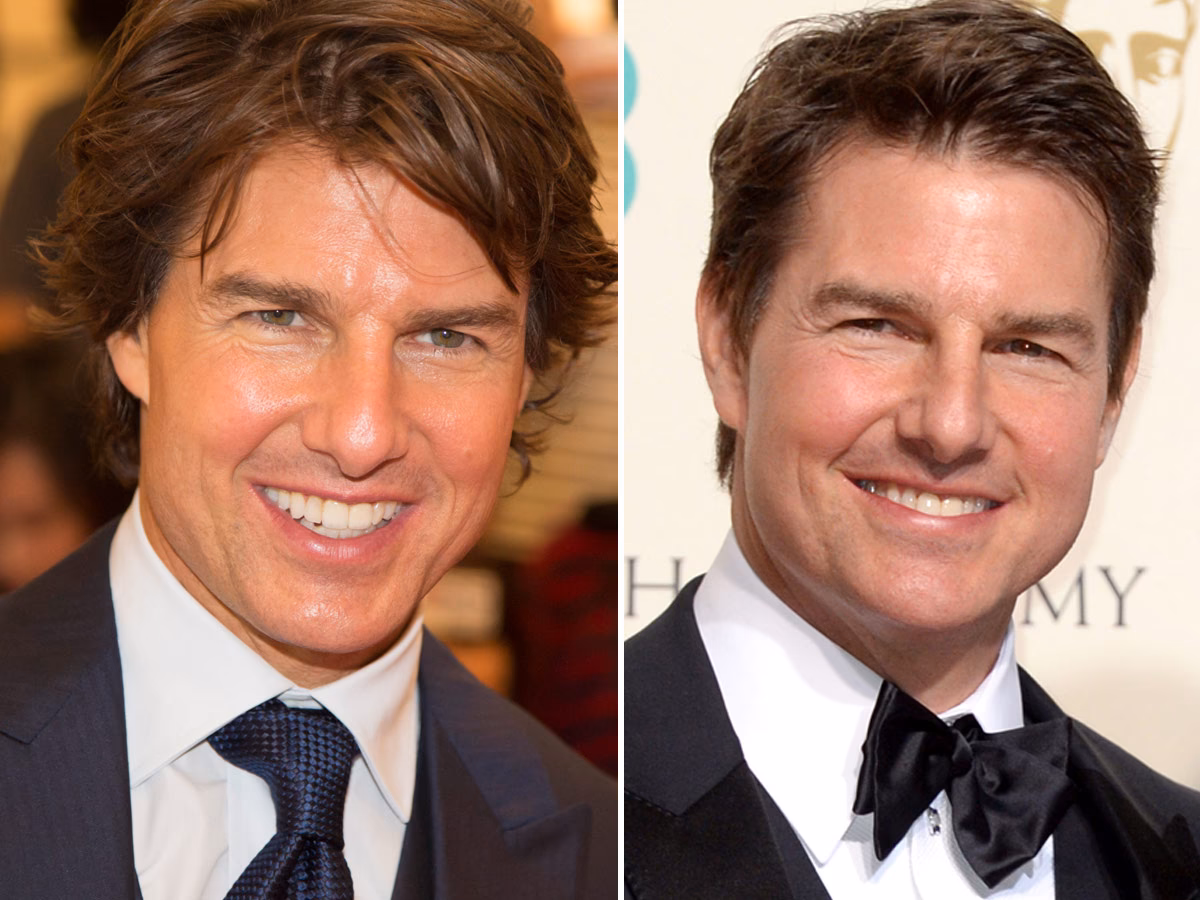 ¿Se operó los dientes Tom Cruise?