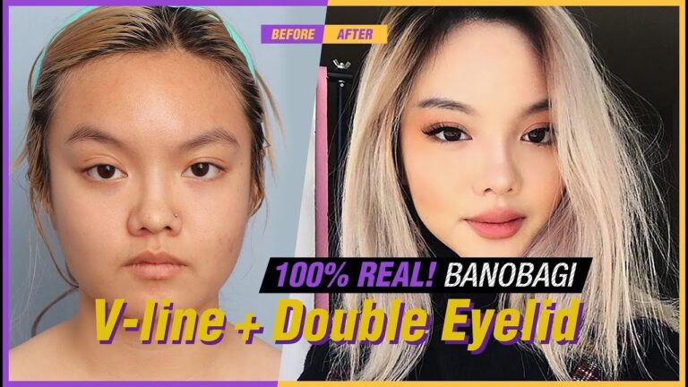 Cirugía Plástica en Corea: ¿Vale la pena el viaje?