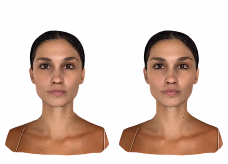 Costo de la Cirugía Plástica en Canadá: Guía 2024