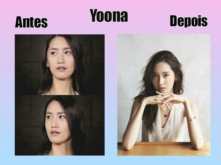 Yina Calderón: El Bisturí y la Fama al Límite